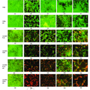 Communauté et interactions microbiennes dans l'environnement