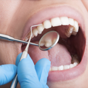 Operatoria Dental