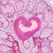 Histopathology [MCU]