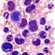 Hematology [MCU]