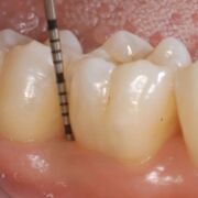 Patient Care III (PR)