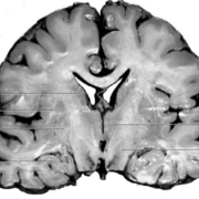 CICLO CLÍNICO MEDICINA