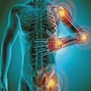 Y3 Exam 1 : Inflammatory Diseases & GI