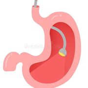 Puntos SeleCTOs - Gastro🔦