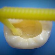 Materiales dentales II // EXAMEN I