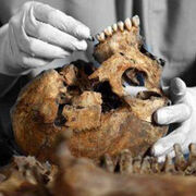 Medicina Legal - Antropologia Forense