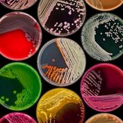 BIO1314 Microbiology🧫🥼🔬