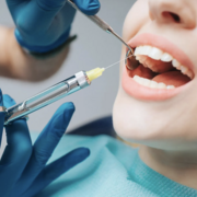 Procedimientos anestésicos en odontología