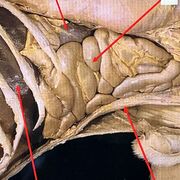 A&P - Block 3 GI Tract