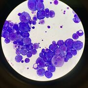 B O D Y F L U I D S uams