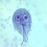 Microbiología Hongos y Protozoarios