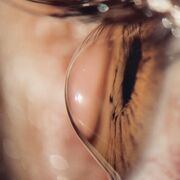 CÓRNEA, ESCLERA & CONJUNTIVA