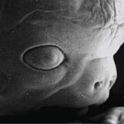 EMBRIOLOGIA E GENÉTICA