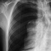 Diagnostico por Imágenes