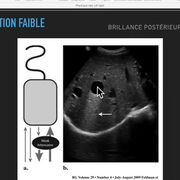 Physique des ultrasons