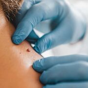 Dermatología MIR 2027