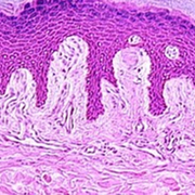 Y1 DBS Histology