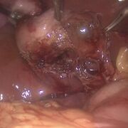 Lecturas De Certificación AMCG 2