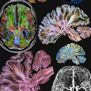 Y2S1| Biopsychology