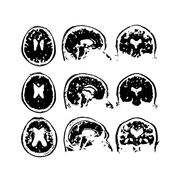 Intro to biological psychology