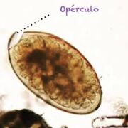 Parasitología - Tremátodos