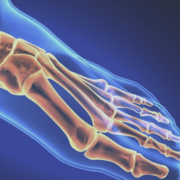 POD1069 Chirurgie AVP