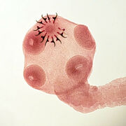 Infectio
