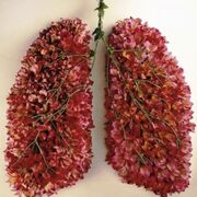 520 Respiratory System I