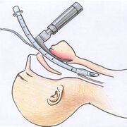 Inhalothérapie appliquée 2 Jess