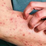 Examen clinique de la peau (session 2)