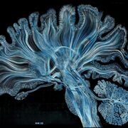 NEUROLOGIA PARCIAL 1