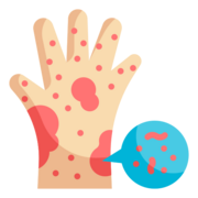 Immune disorders