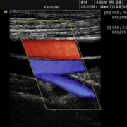 A - RPVI examination