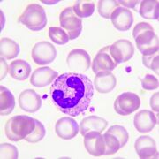 Análisis Clínico - 2