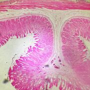 Dor Abdominal, Diarreia, Vômito e Icterícia