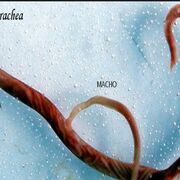 Parasitología - Nemátodos