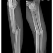 Patho Musculo- Squelettique Et Articulaire