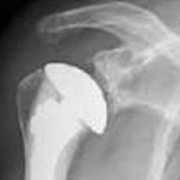 K2-S2 : UE5 Traumatologie