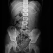 Imagenología ORDINARIO