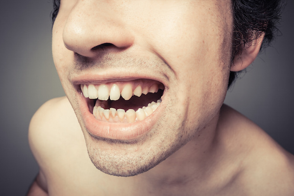 Preventing gingivitis