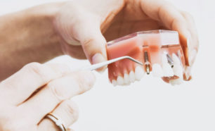 How Long Does it Take For a Cavity to Form? | Artistic Touch Dentistry