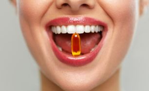 Perfect Smile With Supplements