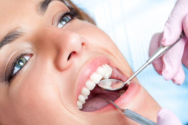 dental bridges