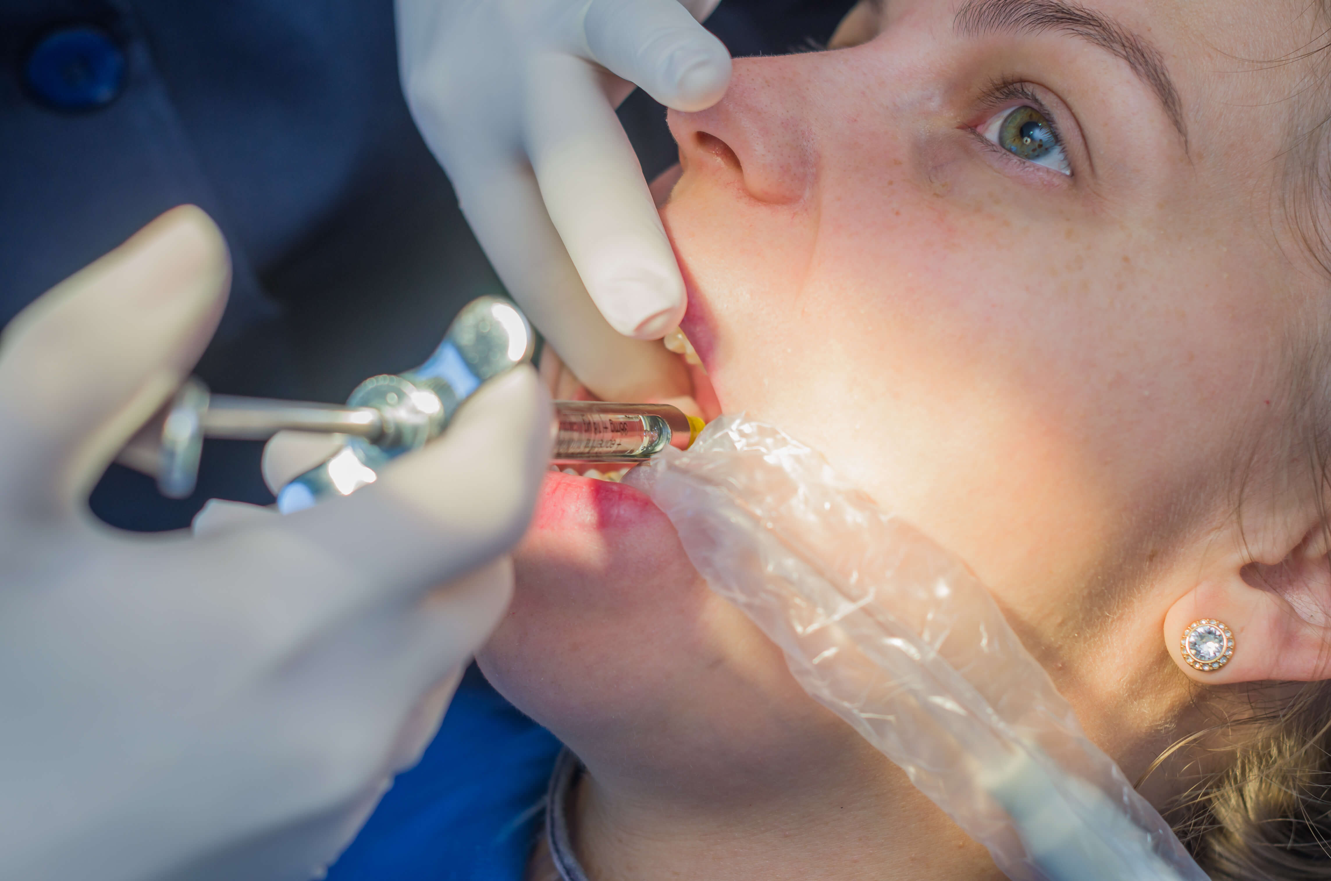 Syringe in mouth