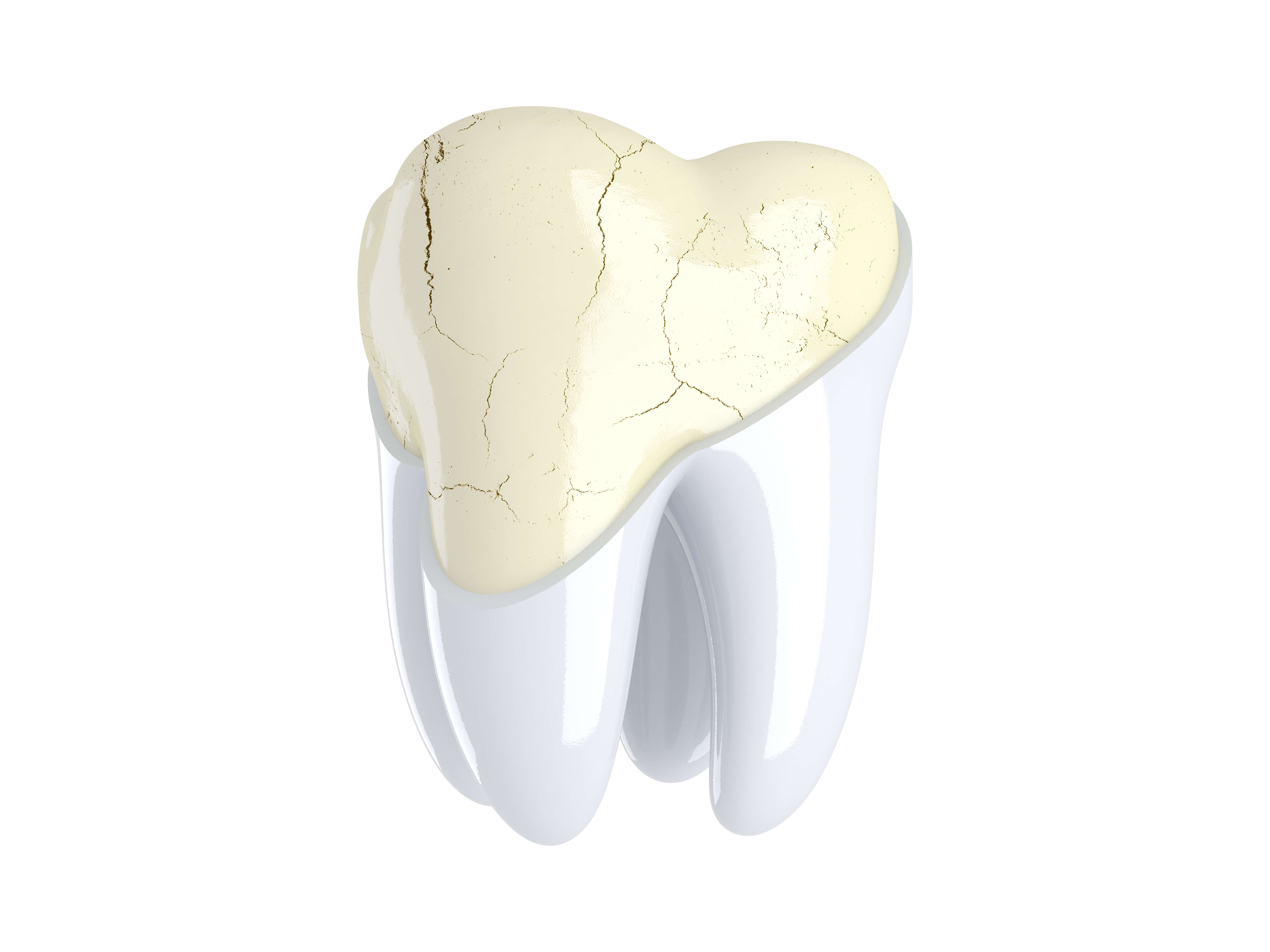 Tooth Enamel
