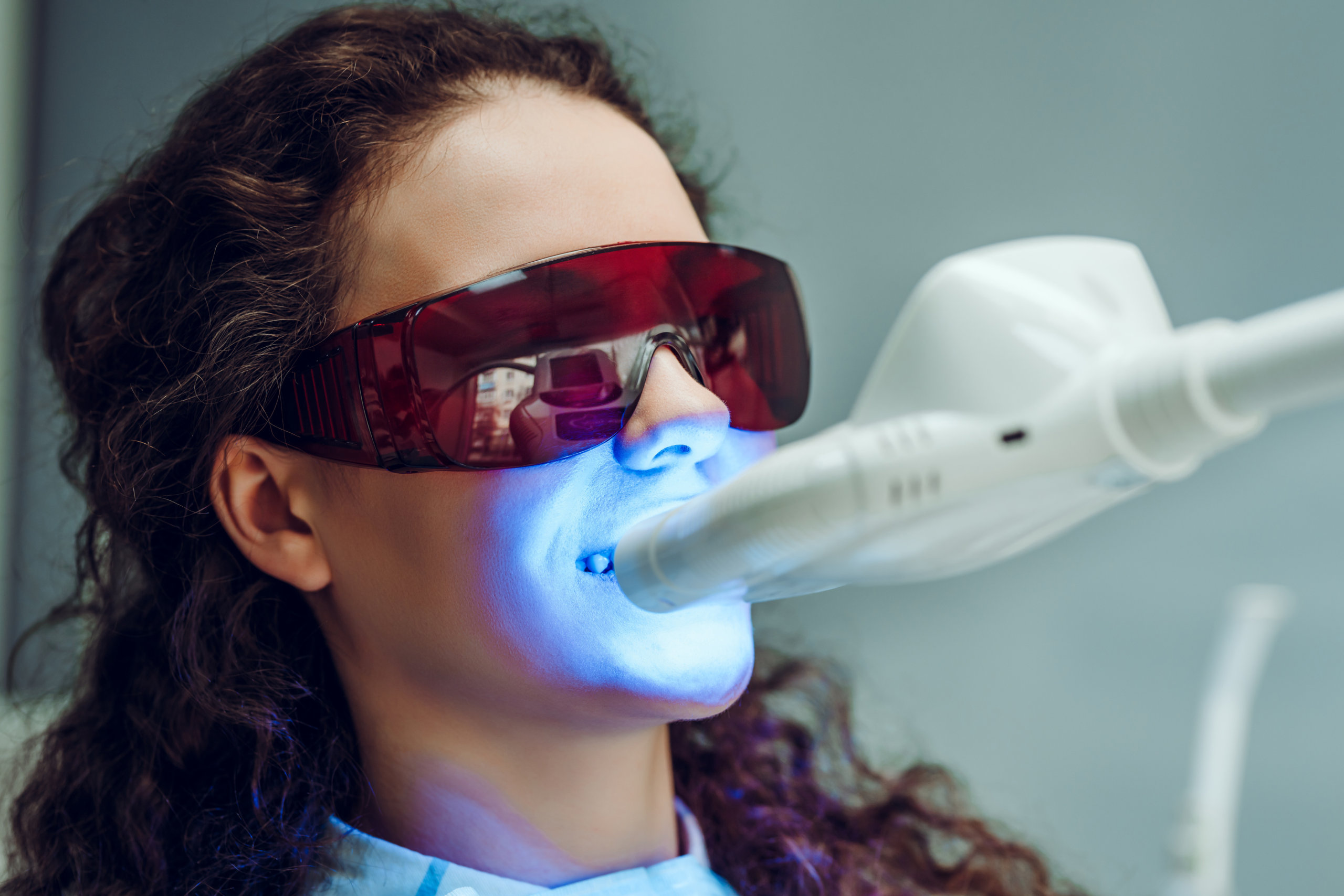 Teeth whitening