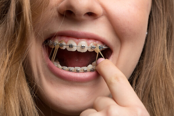 what rubber bands do