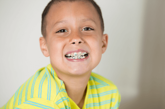 Why We Recommend Starting Early Orthodontic Treatment