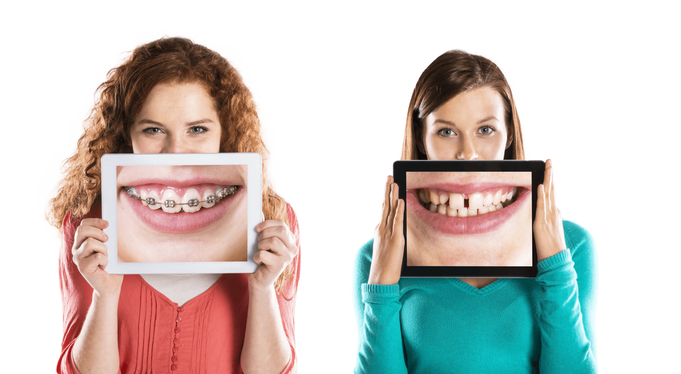 DIY Orthodontics