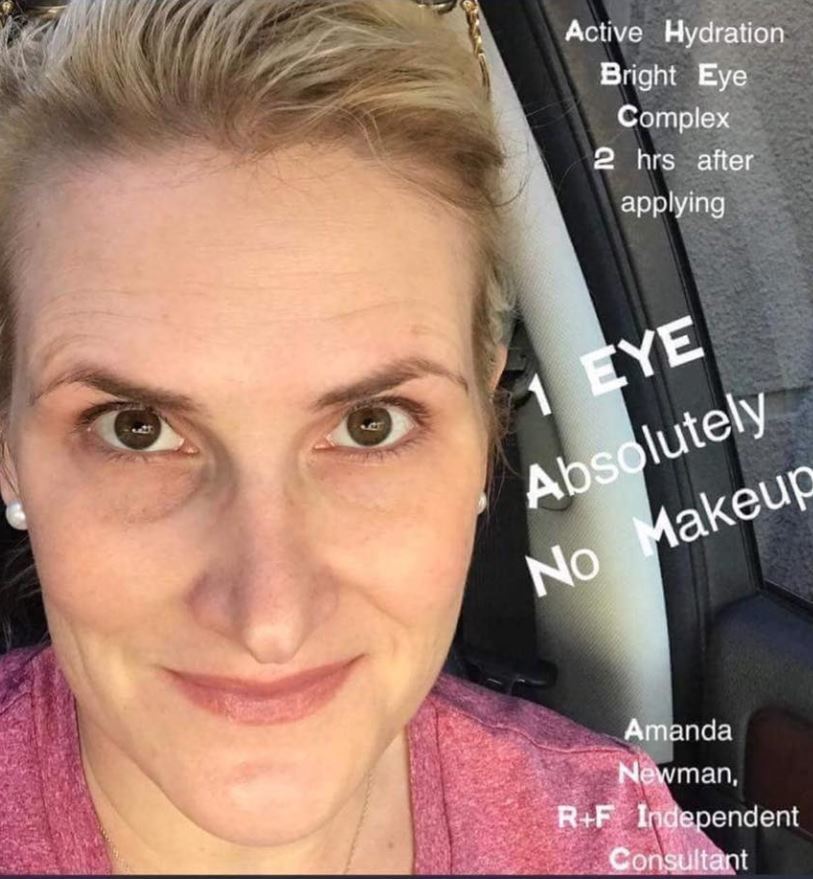 active hydration bright eye complex before and after